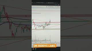 DR REDDYS LABS stock analysis today & latest news #intraday  #shorts #stocks #swingtrading