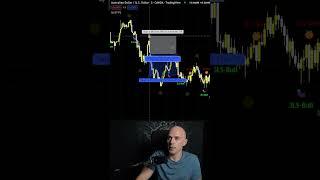 where to place your stop loss day trading #shorts